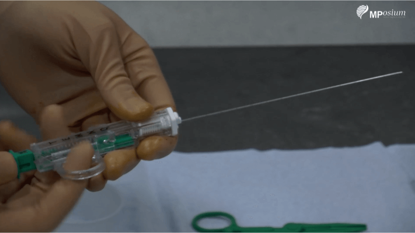 Lung biopsy